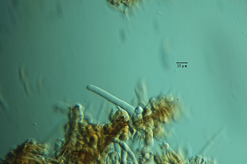 Crustoderma dryinum (Berk. & M.A. Curtis) Parmasto